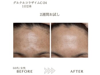 サロンエイトミー 西船橋店(salon 83)/before→after
