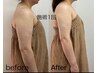 【肩甲骨はがし、巻き肩】上半身生体電流エレクトロセラピー60分