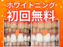 ホワイトニングセンター 大阪茨木店