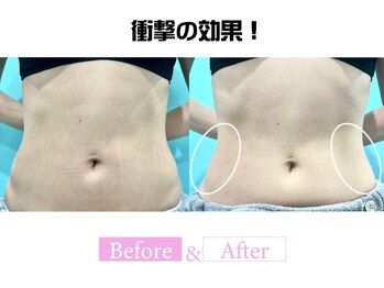 オンダリフト東京 渋谷店/オンダリフト/渋谷/ララピール