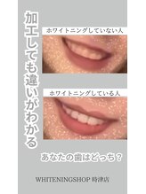 ホワイトニングショップ 長崎時津店/加工しても差が出ます