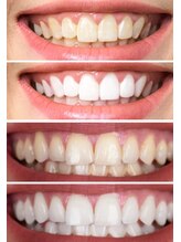 スリーエー(AAA)/いつまでも自分の歯で♪