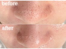 メモリ/30代・40代でも美肌になれます◎