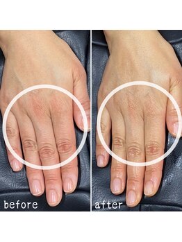 ネイルズ アヴァンティ(Nails Avanti)/美手肌エステ