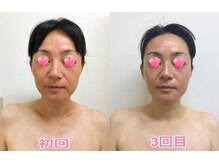 ココロ エステサロン(COCORO)の雰囲気（経験10年以上、複数難関資格の持ち主による施術 ★効果コミット）