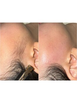 お肌をきれいにしたい