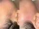 デイジー(Daisyyy)の写真/≪眉毛×フェイシャルWAX≫２つを組み合わせる事でお顔のトーンがUPし、垢抜け眉と同時にツヤ肌までGET☆