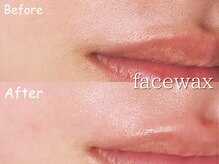 モエラビューティーサロン(Moela beauty salon)の雰囲気（痛み、赤み最小限！産毛、角質、皮脂汚れを除去◎）