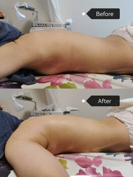 シークレット(Secret)/肩こり解消