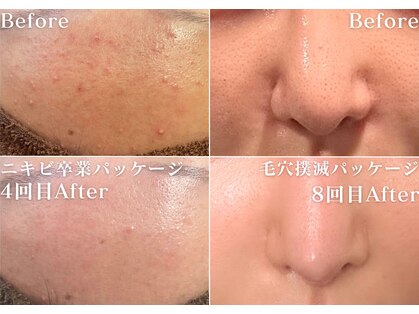 ミニョスキンラボの写真