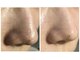 アンジュ ヴィスパ(Ange Vie Spa)の写真