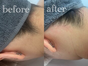 マドンナリリー 恵比寿店(Madonna Lily)/お客様before/after