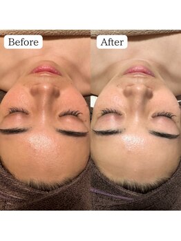 ダリア(DAHLIA)/人気No.1陶肌トリートメント