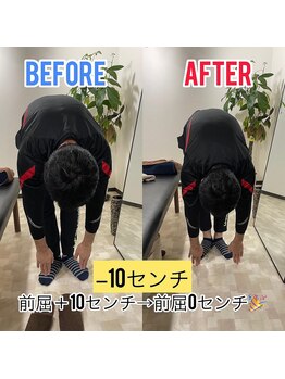 Rストレッチ/【変化】ビフォーアフター