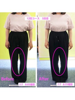 かおりビューティサロン/O脚改善