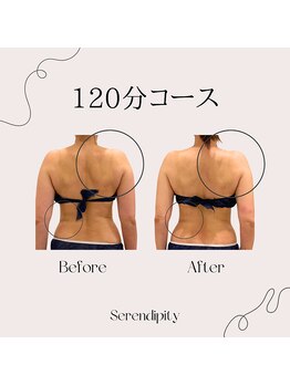 セレンディピティー(Serendipity)/【つらい首肩こり改善】