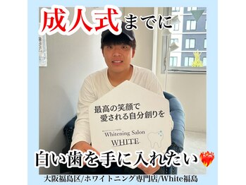ホワイトニングサロン ホワイト(WHITE)/セルフホワイトニング/大阪/福島