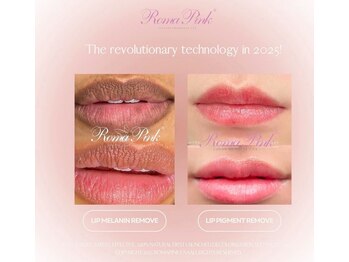 ツキ(TSUKI)/ローマピンク