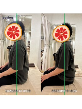 グレフル鍼灸接骨院 整体院 心斎橋/整体/肩こり/マッサージ/腰痛