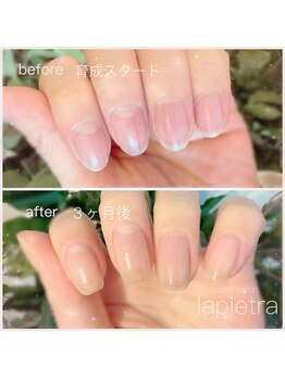ネイルサロン ラピエトラ(la pietra)/最強のネイルケア3ケ月間コース