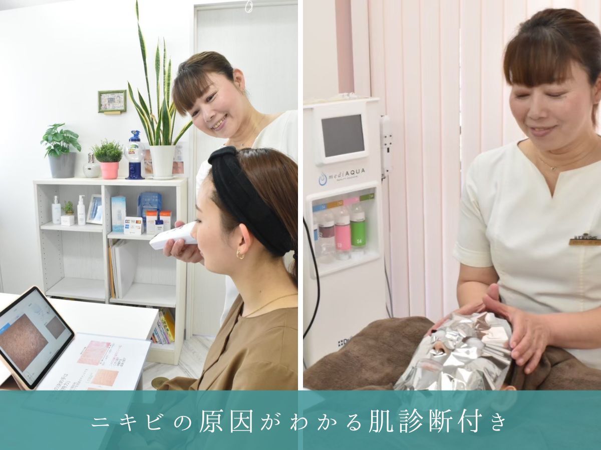 ニキビケア 毛穴研究所 立川店｜ホットペッパービューティー