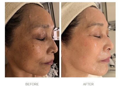 ラシェプリズ(LACHER PRISE)の写真