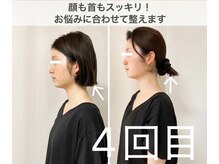 ミラ 長崎駅前店(MIRA)の雰囲気（諦めていたお顔の悩みは正しい方法で改善できます。 長崎_小顔）