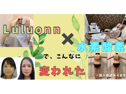 ヨサパーク ネモフィラ(YOSA PARK)の写真