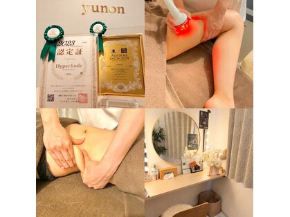 ユノン(yunon)の写真