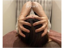 ブリス エナジーアンドサロン 福岡薬院店(bliss energy&salon)/頭筋ほぐし　30分　begfore