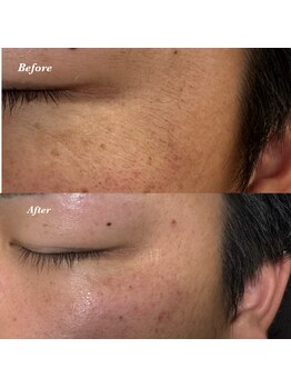 アイブロウドット 西宮(iBROW.)/美眉スタイリングBefore→After