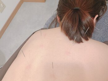 リボーン(reborn)/からだ鍼