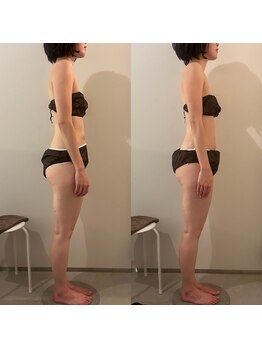 ラナ 京都西院店(Lana)/よもぎ蒸し＆リンパマッサージ