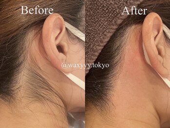 ワクシー 中目黒(WAXYYY.)/夏が来る前に!うなじワックス!