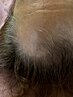 メンズヘアケア、トライアル　髪が気になる、貴方に　ヘッドマッサージ付き