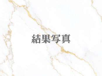 ピオラ(Piora)/ピーリング/毛穴ケア/美白/小顔