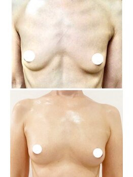 スマイルクルー(SmileClue)/ビフォーアフター症例