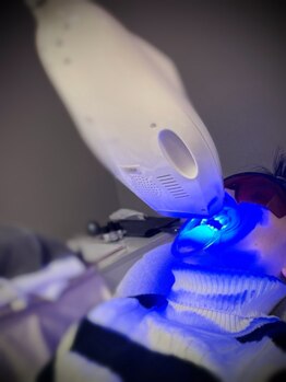 ウィンサムテン 新宿店(Winsome)/ホワイトニングで黄ばんだ歯を