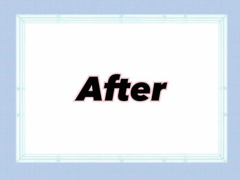 エルミューノ(elμno)/アフター