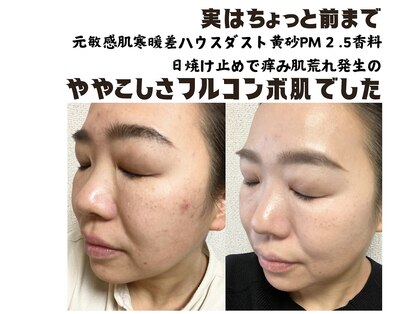 ギフト(gift)の写真