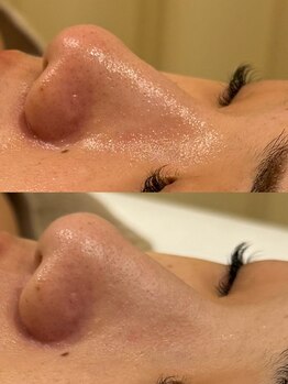 セレニテ(Serenite)/