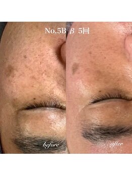 ビーカーブス 三鷹(B.curves)/before・after