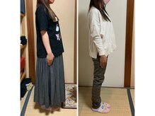 リンドール(RinDoll)/30代女性ダイエット/耳ツボ/痩身