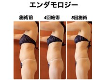 イスタナ ロゼ/エンダモロジー