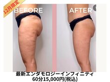 アムール 麻布十番(Amour)