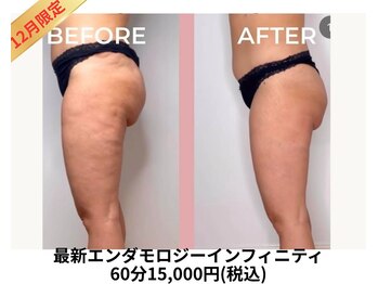 アムール 麻布十番(Amour)