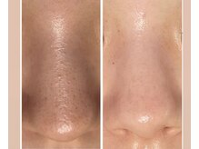 アロマビューティーサロン ジェイハウス(J)の雰囲気（ エナジーテラピーは、心身のバランスを整えること代替療法。）