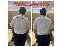 きむら整骨院 鍼灸院の雰囲気(やらせじゃありません!(笑)腰の痛みでご来院2回目の状態です)