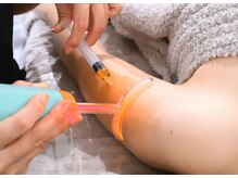 リバース 大阪店(Rebirth)/ダウンタイム・リバンドなし