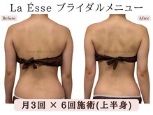 ラエッセ(La Esse)/むくみがとれてすっきり後ろ姿